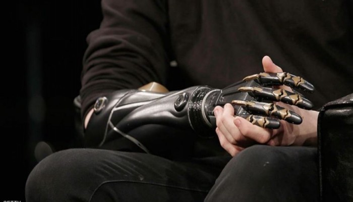 علماء يطورون يدًا روبوتية لمرضى شلل الأطراف