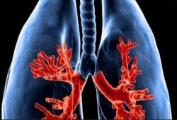 خطوات بسيطة تحميك من أمراض الرئة أهمها تمرينات التنفس