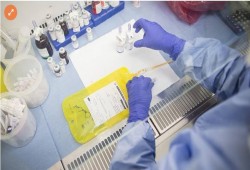 طريقة جديدة ترفع نسب نجاح تشخيص سرطان البروستاتا إلى 93%