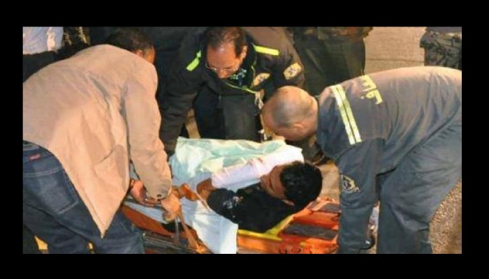 الطعام الفاسد يتسبب فى تسمم 10 أشخاص بالبحيرة