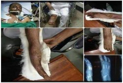 الإهمال الطبى يلاحق "احمد نصر" وذويه يطالبون بإنقاذه من موت بطئ