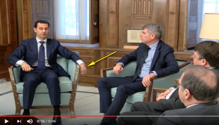 ظهور بشار الأسد يؤكد إصابته بجلطة دماغية (فيديو)