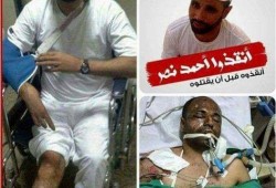 إدانة الإهمال الطبي بحق معتقل "أحمد نصر" وتحميل إدارة السجن مسئولية سلامته