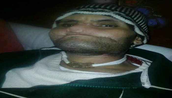 أهالي إيتاى البارود يستغيثون من الانفلات الأمني بعد حادث مروع بالمدينة