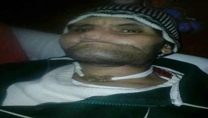 أهالي إيتاى البارود يستغيثون من الانفلات الأمني بعد حادث مروع بالمدينة