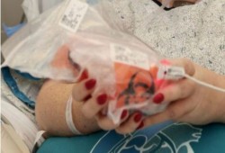 لأول مرة في تاريخ البشرية.. سيدة تُمسك قلبها بيديها