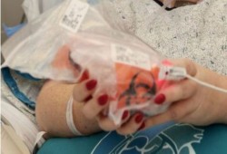 لأول مرة في تاريخ البشرية.. سيدة تُمسك قلبها بيديها