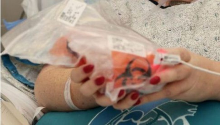 لأول مرة في تاريخ البشرية.. سيدة تُمسك قلبها بيديها