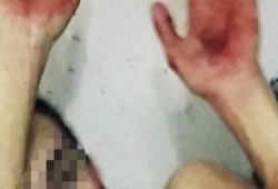 خاطفو 6 مصريين فى ليبيا يبتزون ذويهم بصور تعذيب جديدة لدفع الفدية