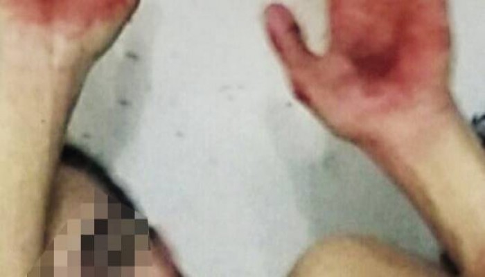 خاطفو 6 مصريين فى ليبيا يبتزون ذويهم بصور تعذيب جديدة لدفع الفدية