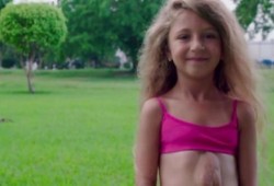 قلبها خارج جسدها وما زالت على قيد الحياة منذ 8 سنوات