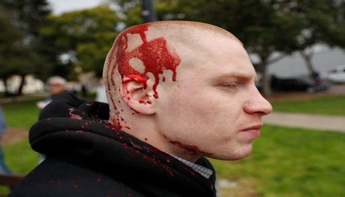 اشتباكات دامية بين مؤيدين ومعارضين للرئيس الأميرِكي