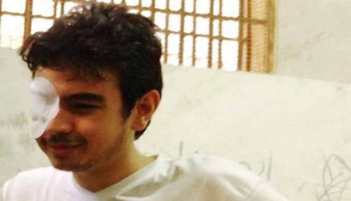 "مخ" المعتقل أنس موسى في خطر