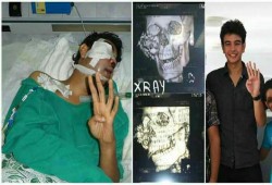 "أنس" معتقل ظلما منذ عامين.. ويواجه أزمة في "عينه"