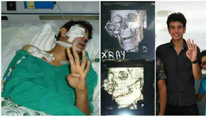 "أنس" معتقل ظلما منذ عامين.. ويواجه أزمة في "عينه"