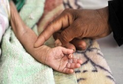 برنامج الأغذية: اليمن يمثل "أكبر حالة طوارئ" لانعدام الأمن الغذائي بالعالم