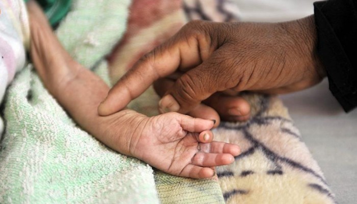 برنامج الأغذية: اليمن يمثل "أكبر حالة طوارئ" لانعدام الأمن الغذائي بالعالم