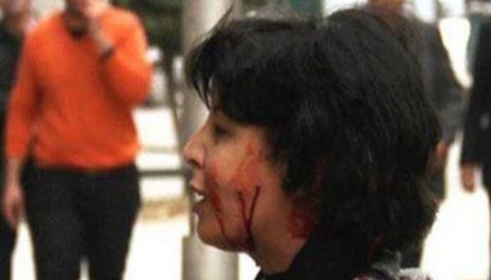 الطب الشرعي: إصابة شيماء من خرطوش يوجد مع الشرطة