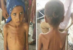 الصليب الأحمر يحذر: الوضع الغذائي في تعز كارثي