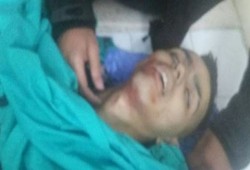 شهيد و3 إصابات "حرجة" برصاص الاحتلال قرب رام الله