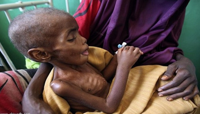 نداء أممي عاجل لجمع 255 مليون دولار لإنقاذ 22 مليون طفل