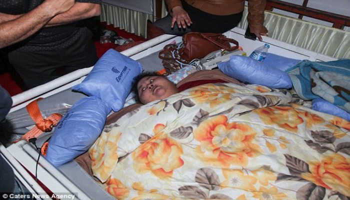 مرض جيني غير متكرر وراء سمنة إيمان عبدالعاطي