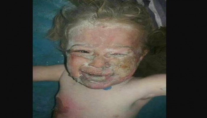 الطيران الروسي يقصف الأبرياء بـ"أورم الكبرى" بريف حلب