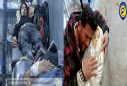 حالات اختناق وشهداء أطفال في الغوطة الشرقية بسوريا