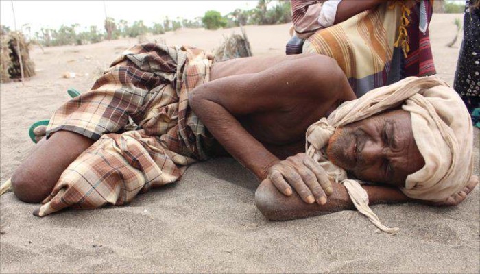 تحذيرات أممية من عواقب كارثية لمجاعة باليمن