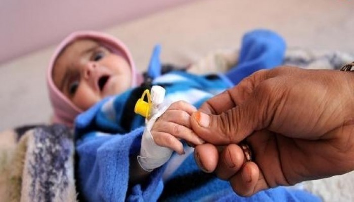 الأمم المتحدة: نصف مليون طفل يمني يوشكون على الموت