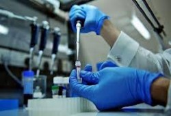 عقار جديد يعالج مرضى التصلب الجانبي الضموري