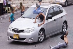 إصابة طفل دهسه شرطي "إسرائيلي" بالقدس المحتلة
