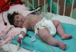 نفاد 170 صنفَ دواء من مخازن "الصحة" بغزة