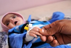 مسؤول أممي: الكوليرا تهدد حياة مليون إمرأة حامل في اليمن