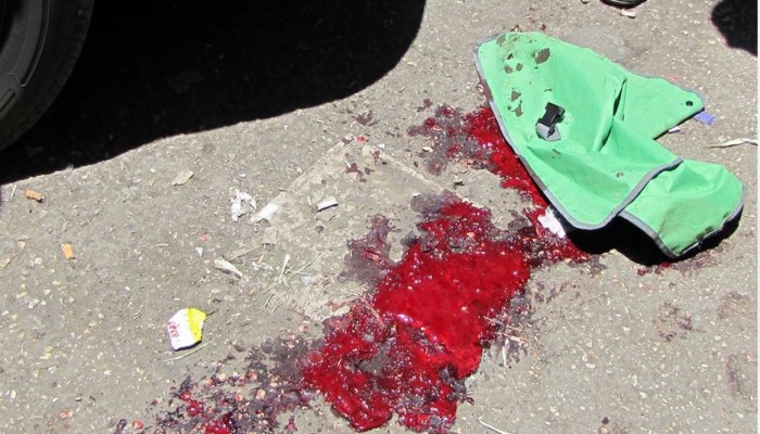 إصابة شاب برصاص مجهول وسط جنين بالضفة الغربية