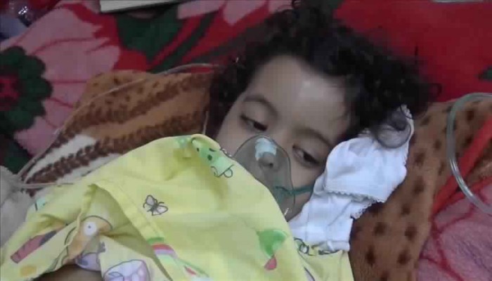 الأمم المتحدة تحذّر.. انتشار خطير لـ"شلل الأطفال" في دير الزور السورية