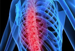 توصيات طبية ذهبية لمرضى هشاشة العظام