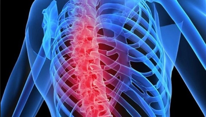 توصيات طبية ذهبية لمرضى هشاشة العظام