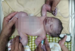 حماس: وقف عباس تحويلات مرضى غزة جرائم ضد الإنسانية