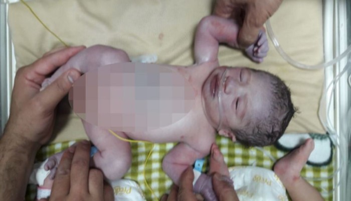 حماس: وقف عباس تحويلات مرضى غزة جرائم ضد الإنسانية