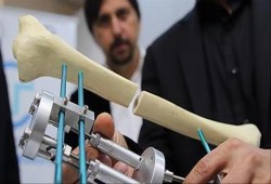 باحثون أمريكيون يكتشفون دورًا جديدًا للعظام في الجسم