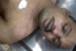 وفاة سجين داخل قسم شرطة الأقصر أكد ذووه وجود كدمات في جسده