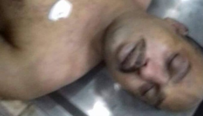 وفاة سجين داخل قسم شرطة الأقصر أكد ذووه وجود كدمات في جسده