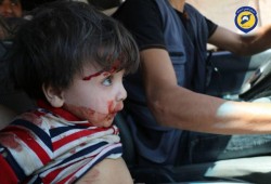 غارات منذ الصباح الباكر على الغوطة الشرقية.. شهداء وجرحى في صفوف المدنيين