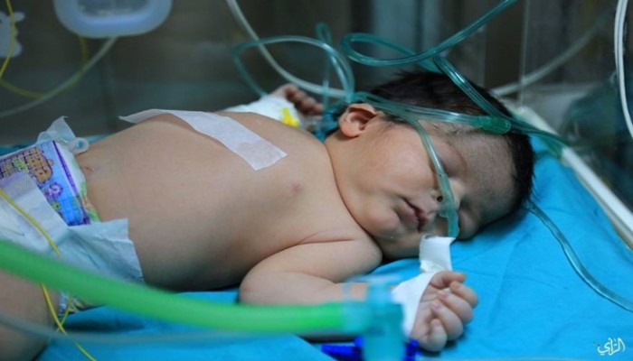 الصحة بغزة تعلن عن شهيد الحصار رقم 19