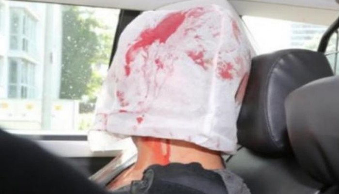 قتيل وجرحى في هجوم بسكين في متجر بهامبورغ الألمانية