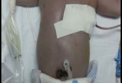 تقرير حقوقي: ما ترتكبه سلطة عباس والاحتلال بحق مرضى غزة جرائم حرب