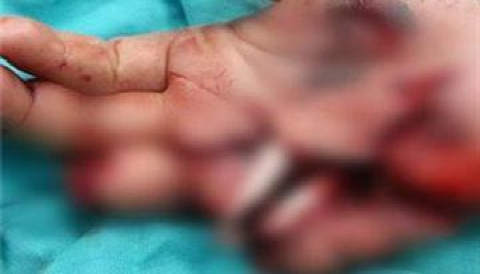 في عهد الانقلاب.. وجبة إفطار تكلف صاحبها قطع إصبعيه بالشرقية