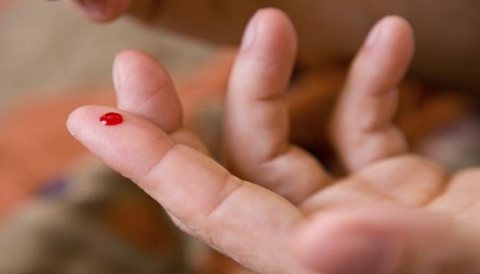 دراسة: لعق الجروح يساعد على التئامها بسرعة
