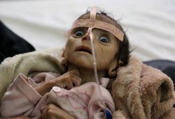 اليمن والصومال ونيجيريا وجنوب السودان.. مربع تهدده المجاعة والنزاعات المسلحة